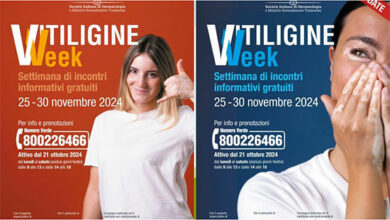 vitiliggine week - calabria